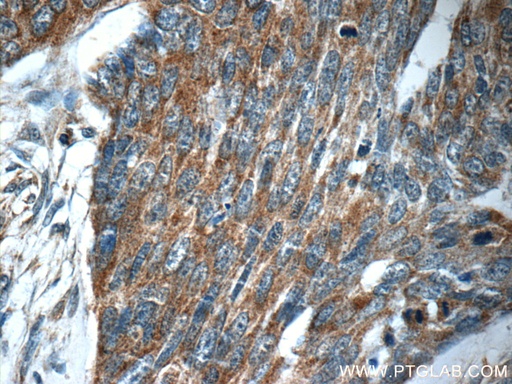 [15989-1-AP-20UL] MRPS26 Polyclonal antibody