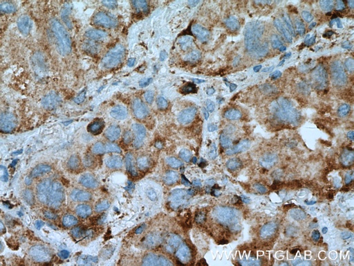 [15995-1-AP-20UL] PRCP Polyclonal antibody