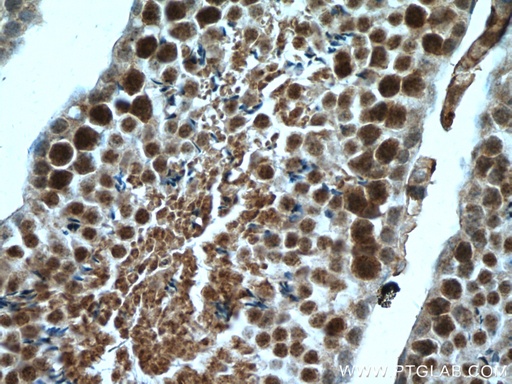 [15996-1-AP-20UL] RTCD1 Polyclonal antibody