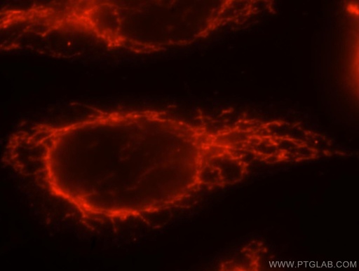 [15999-1-AP-150UL] ATP5F1 Polyclonal antibody