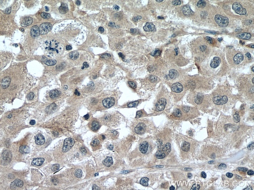 [16000-1-AP-20UL] FGL1 Polyclonal antibody
