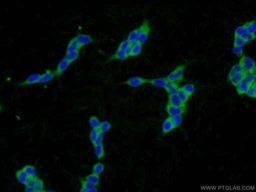 [16009-1-AP-20UL] PLA2G12A Polyclonal antibody