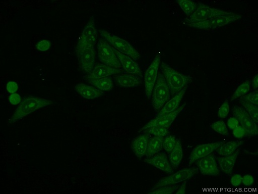 [16010-1-AP-20UL] LAS1L Polyclonal antibody