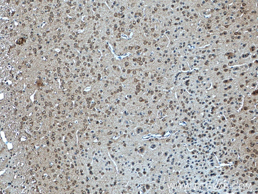 [16011-1-AP-20UL] CYFIP1/2 Polyclonal antibody