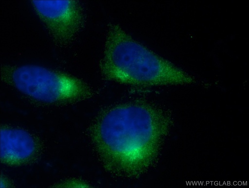[16012-1-AP-150UL] ARL1 Polyclonal antibody