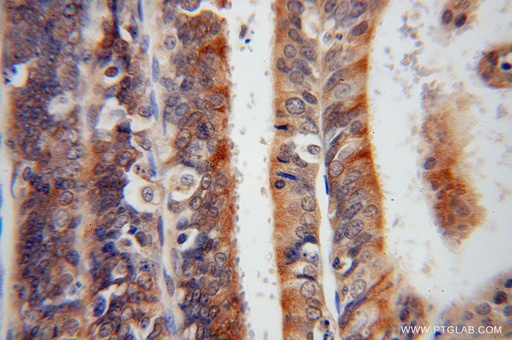 [16013-1-AP-20UL] Syntaxin 18 Polyclonal antibody