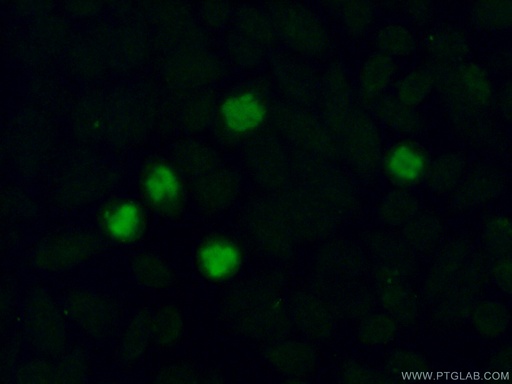 [16015-1-AP-20UL] MMS19 Polyclonal antibody