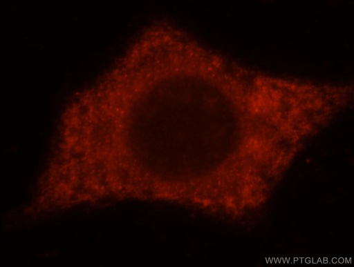 [16016-1-AP-150UL] TXNDC4 Polyclonal antibody