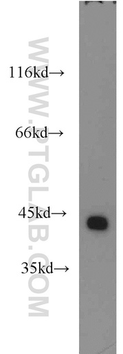 [16017-1-AP-20UL] ILKAP Polyclonal antibody