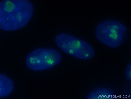 [16021-1-AP-150UL] FBL Polyclonal antibody