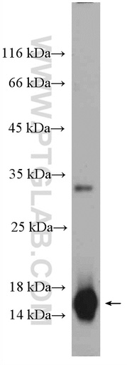[16025-1-AP-150UL] CST1 Polyclonal antibody
