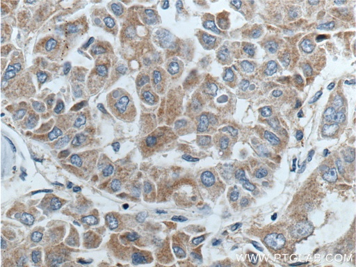 [16026-1-AP-150UL] BCL2L2 Polyclonal antibody