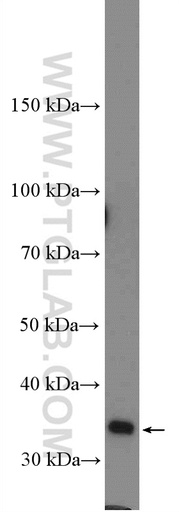 [16039-1-AP-150UL] TUSC3 Polyclonal antibody