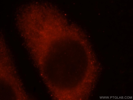 [16041-1-AP-150UL] IFFO1 Polyclonal antibody