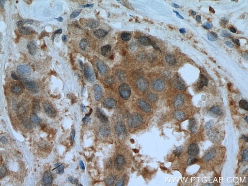 [16045-1-AP-20UL] PFDN4 Polyclonal antibody