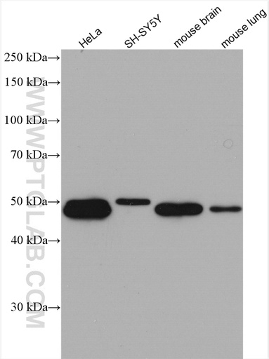[16049-1-AP-20UL] SNX15 Polyclonal antibody