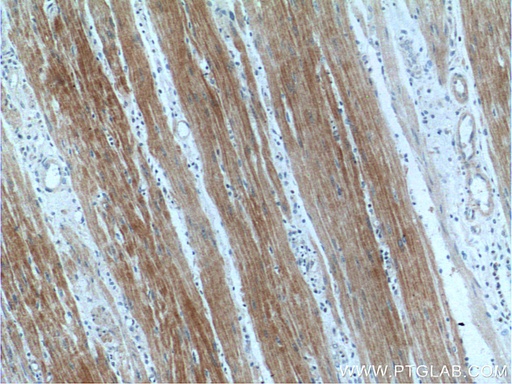 [16050-1-AP-20UL] SULT1B1 Polyclonal antibody
