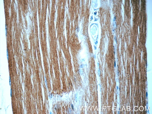 [16052-1-AP-20UL] MYLPF Polyclonal antibody