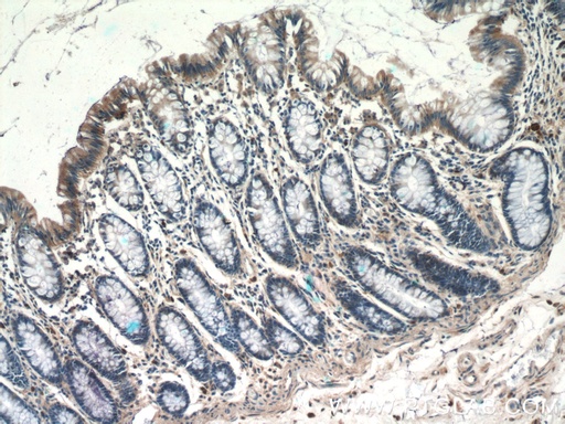 [16058-1-AP-150UL] TSPAN1 Polyclonal antibody