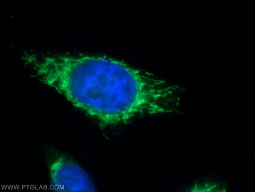 [16064-1-AP-20UL] PMPCB Polyclonal antibody