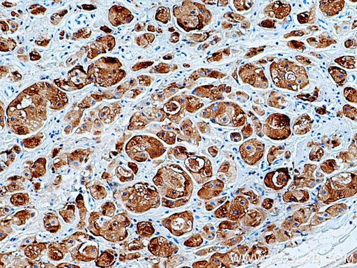 [16068-1-AP-150UL] GCDFP-15/PIP Polyclonal antibody