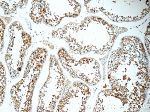[16078-1-AP-150UL] TCN1 Polyclonal antibody