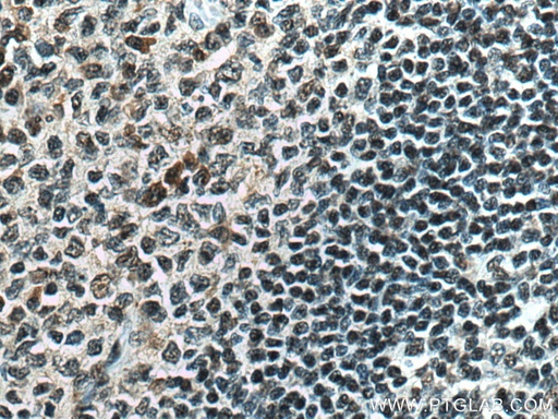 [16082-1-AP-150UL] PCIF1 Polyclonal antibody