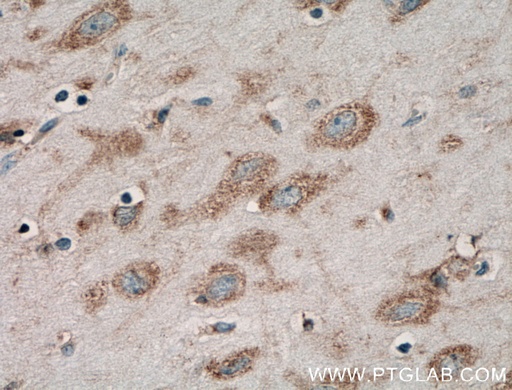 [16087-1-AP-150UL] Acetyl CoA synthetase Polyclonal antibody