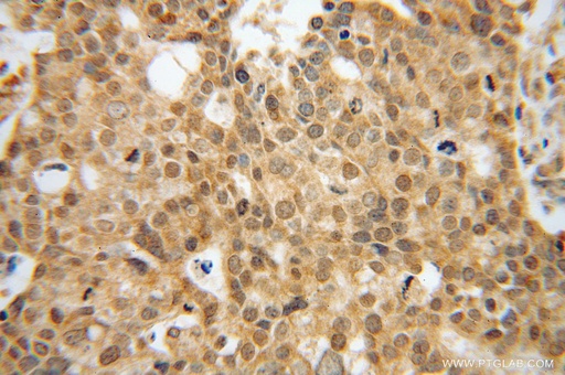 [16091-1-AP-20UL] EEF1A2 Polyclonal antibody