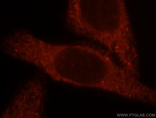 [16099-1-AP-20UL] BBOX1 Polyclonal antibody