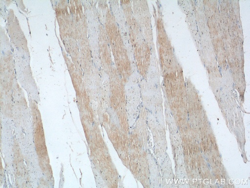 [16102-1-AP-150UL] TNNI1 Polyclonal antibody