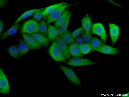 [16105-1-AP-20UL] S100A4 Polyclonal antibody