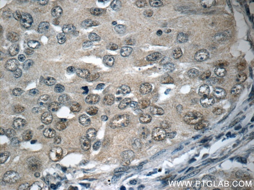 [16107-1-AP-20UL] HSF1 Polyclonal antibody