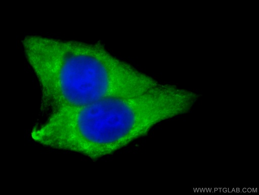 [16112-1-AP-20UL] LPCAT1 Polyclonal antibody