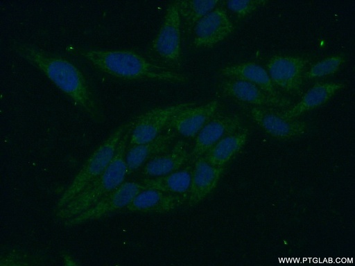 [16115-1-AP-20UL] PPP1R8 Polyclonal antibody