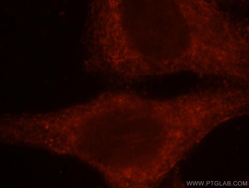 [16117-1-AP-20UL] RAC1/2/3 Polyclonal antibody