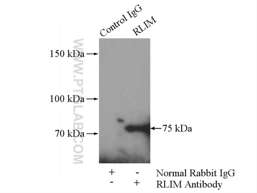 [16121-1-AP-150UL] RLIM Polyclonal antibody
