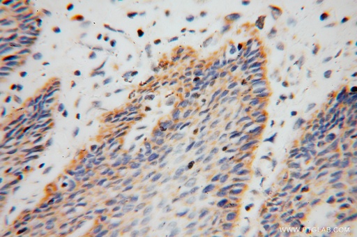 [16122-1-AP-20UL] ARHGDIB Polyclonal antibody