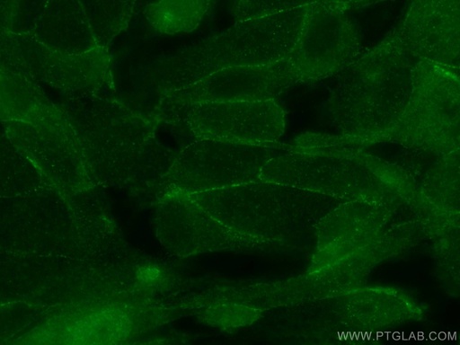 [16124-1-AP-20UL] TARA Polyclonal antibody