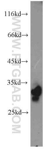 [16125-1-AP-150UL] PHYHD1 Polyclonal antibody