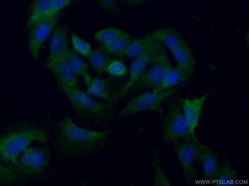 [16126-1-AP-150UL] PGAM1 Polyclonal antibody