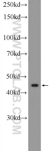 [16127-1-AP-150UL] CLMP Polyclonal antibody