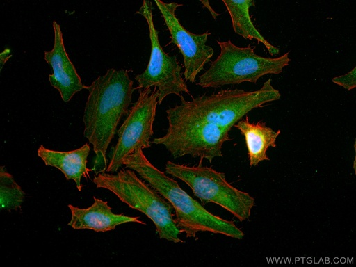 [16128-1-AP-20UL] NXN Polyclonal antibody