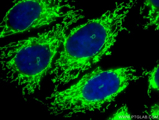 [16131-1-AP-150UL] Citrate synthase Polyclonal antibody