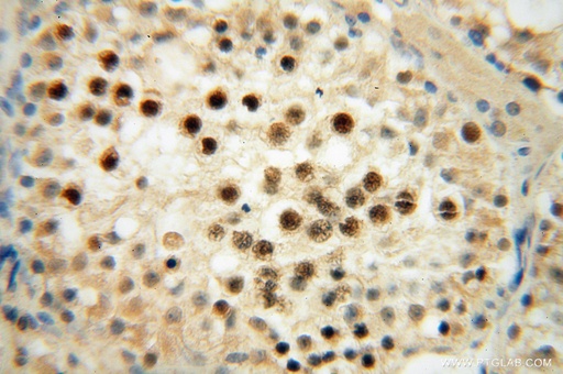 [16132-1-AP-150UL] RNASEH2A Polyclonal antibody