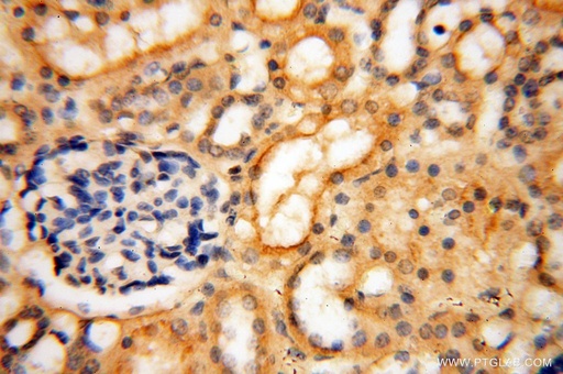 [16133-1-AP-150UL] MUL1 Polyclonal antibody