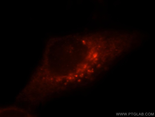 [16134-1-AP-20UL] ITPA Polyclonal antibody