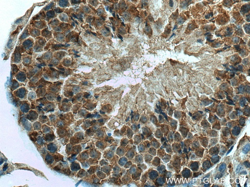[16135-1-AP-150UL] UBXN1 Polyclonal antibody