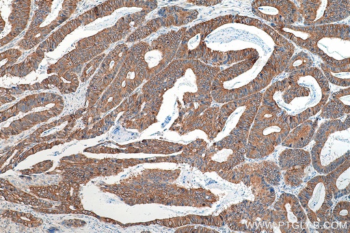 [16136-1-AP-20UL] LAD1 Polyclonal antibody