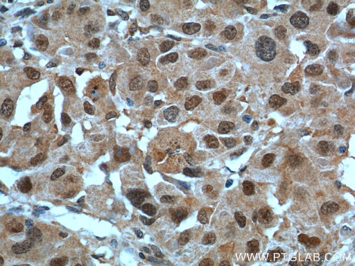 [16145-1-AP-150UL] POLR1E Polyclonal antibody